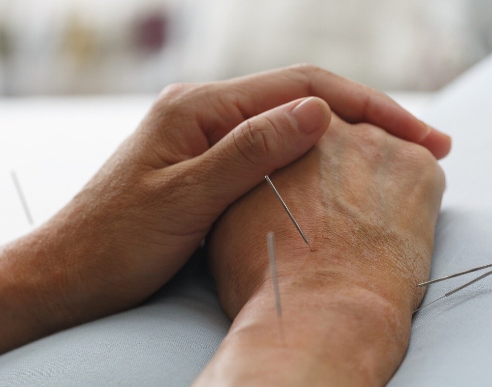 acupuncture weakens mental problems that dementia cause