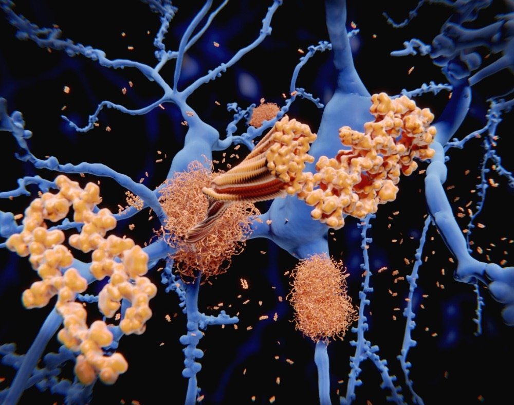 beta amyloid omega 3 dementia