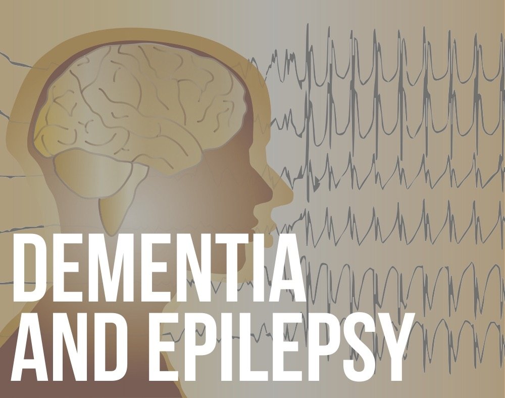 dementia and epilepsy