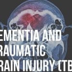 dementia and traumatic brain injury (TBI)