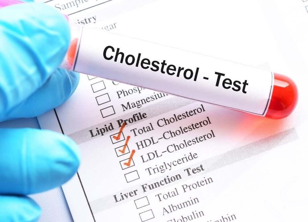 there are two types of cholesterol