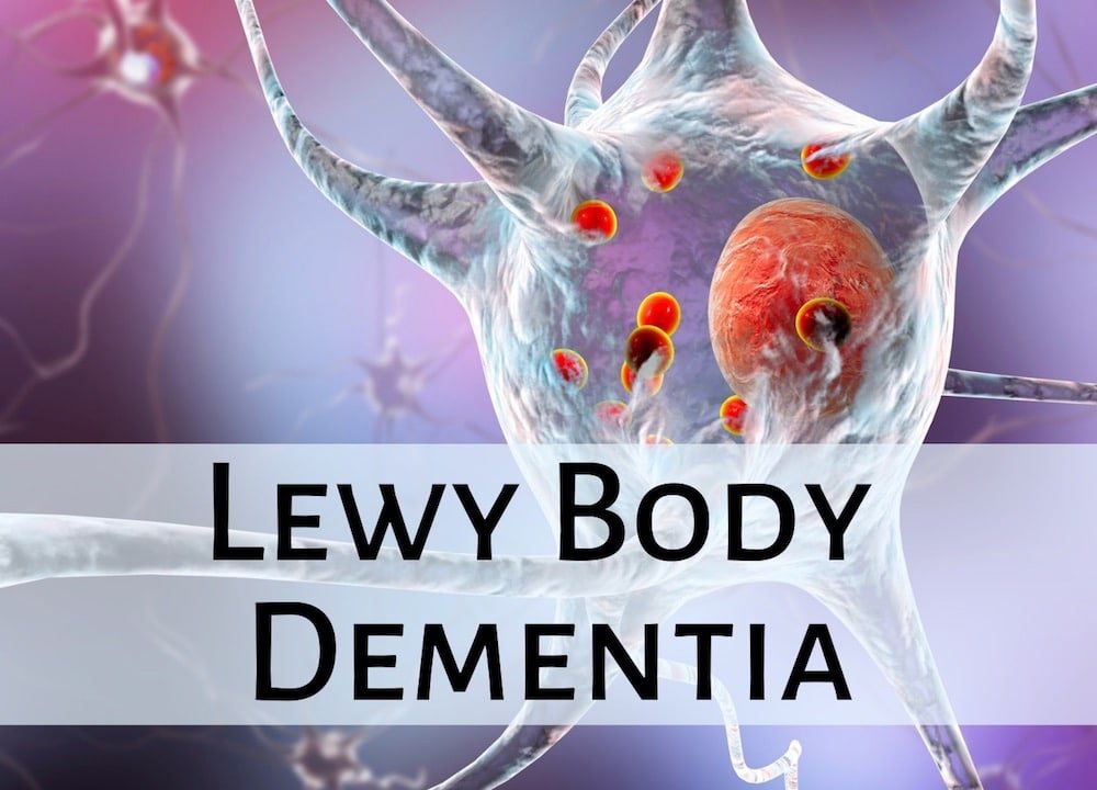 research on lewy body dementia