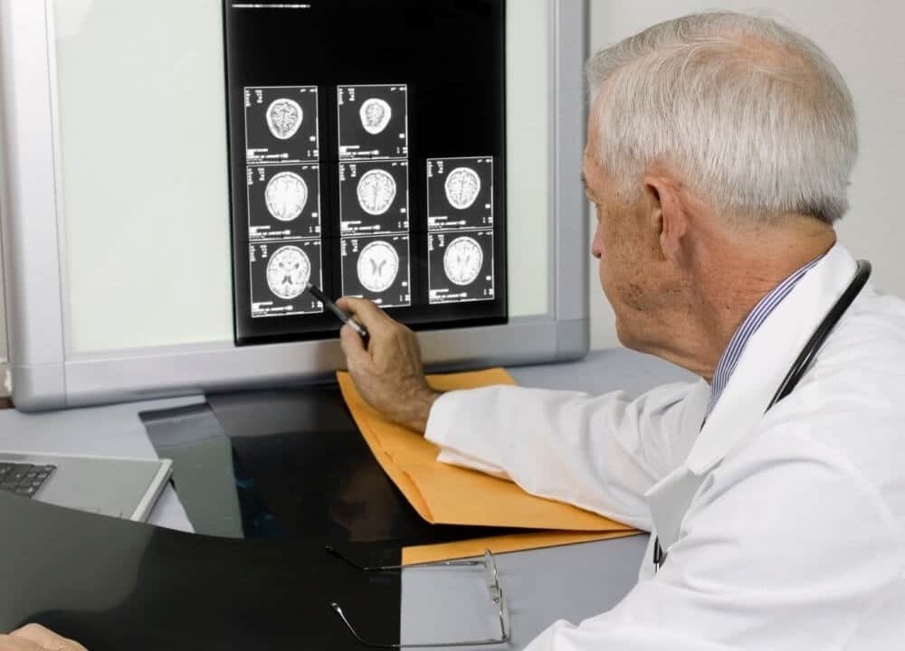 treatment options for stroke related dementia