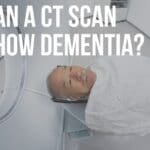 can A CT scan show dementia
