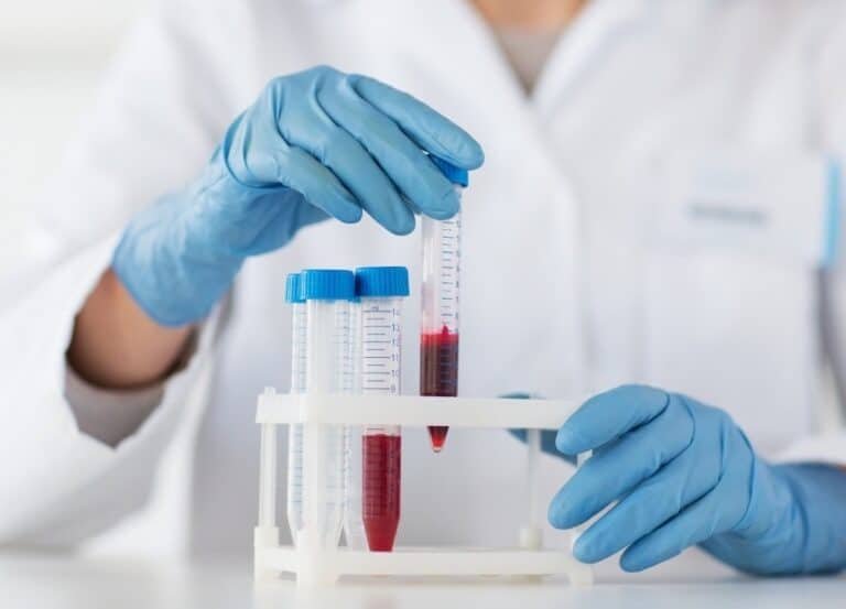 Blood Test for Dementia and Alzheimer’s ReaDementia